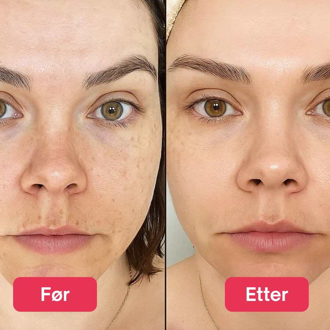 LED Lysterapi Ansiktsmaske