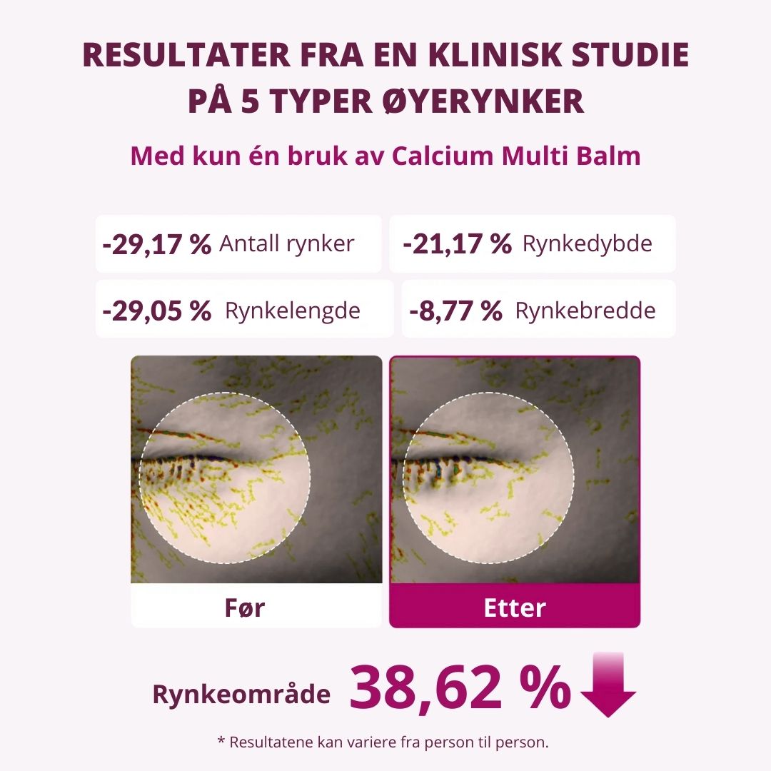 Kalsium Multi-balm + Øyemaske