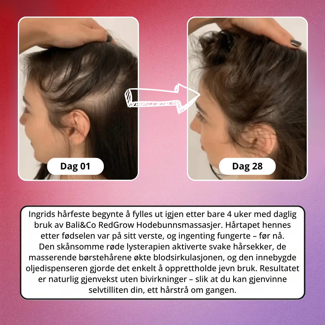 Lunaria RedGrow Hodebunnsmassasjer
