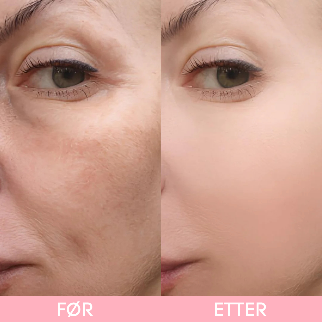 Lunaria™ Peel Shot Glow risampulle-duo