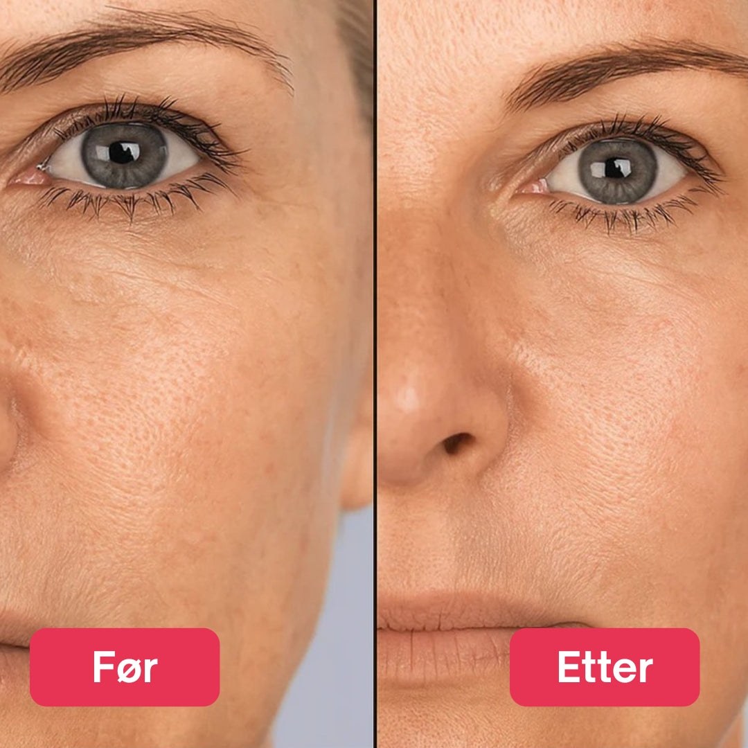 LED Lysterapi Ansiktsmaske