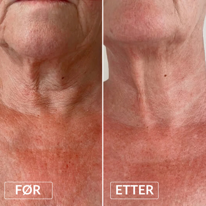 Bio-kollagen Anti-age Nakkemaske