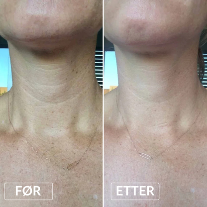 Bio-kollagen Anti-age Nakkemaske