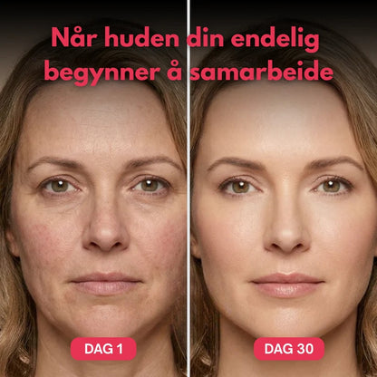 HudBooster Pro + Triple Kollagenkrem