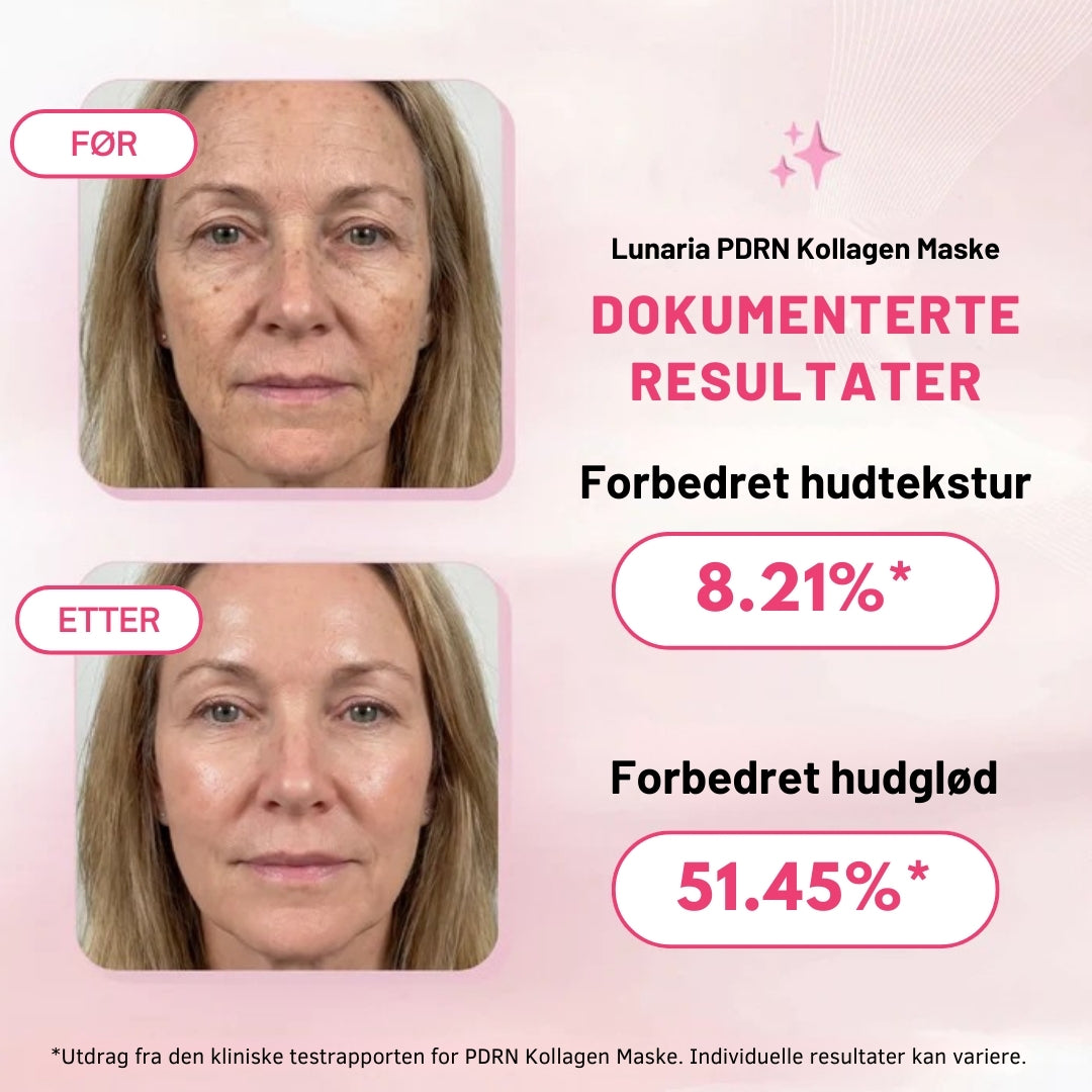 Lunaria PDRN Kollagen Maske