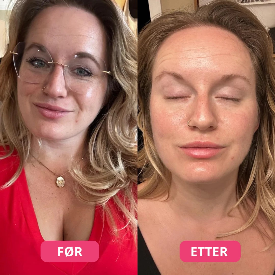 Bio-kollagen Maske