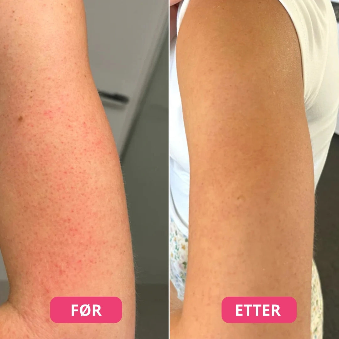 Lunaria Peelspray