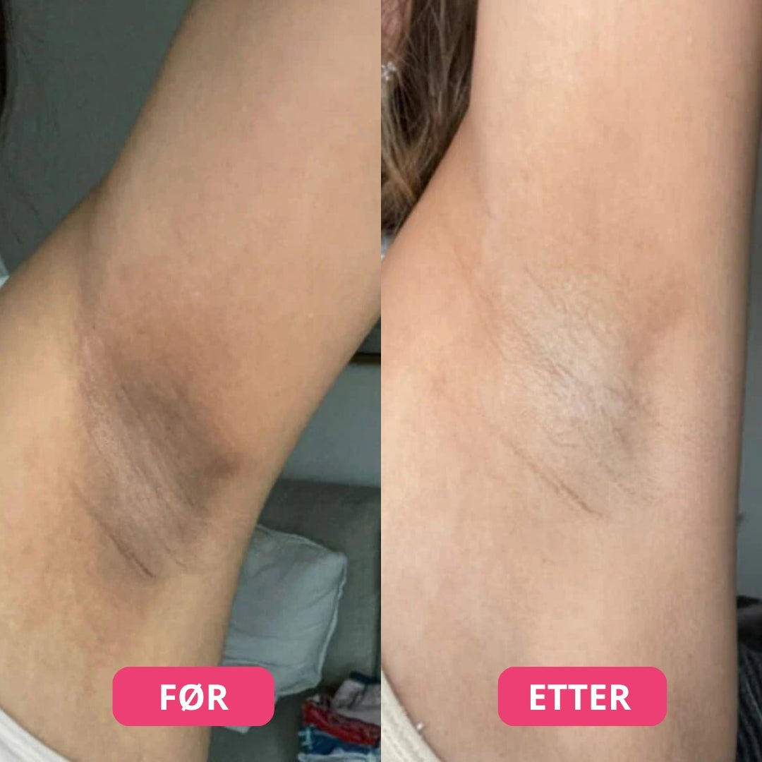 Lunaria Peelspray