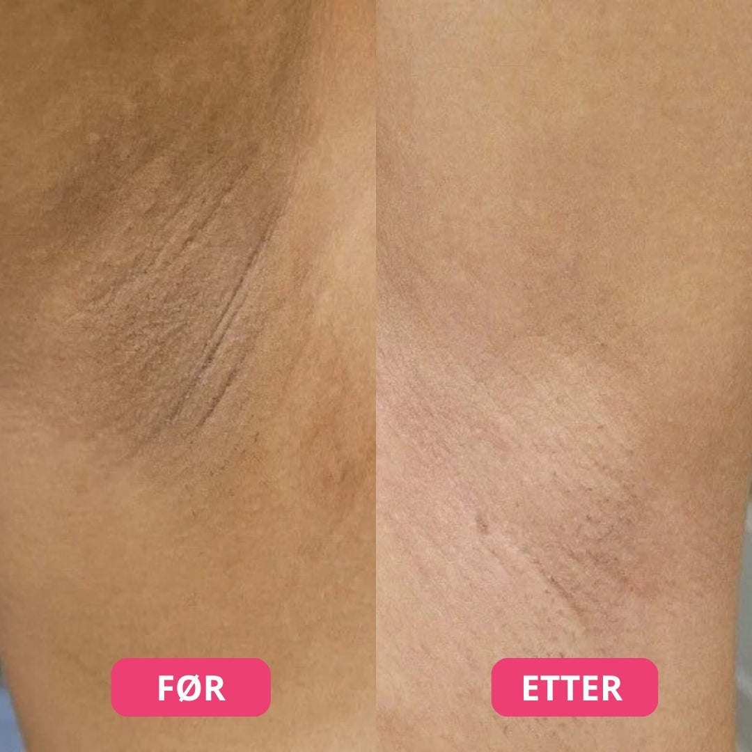 Lunaria Peelspray