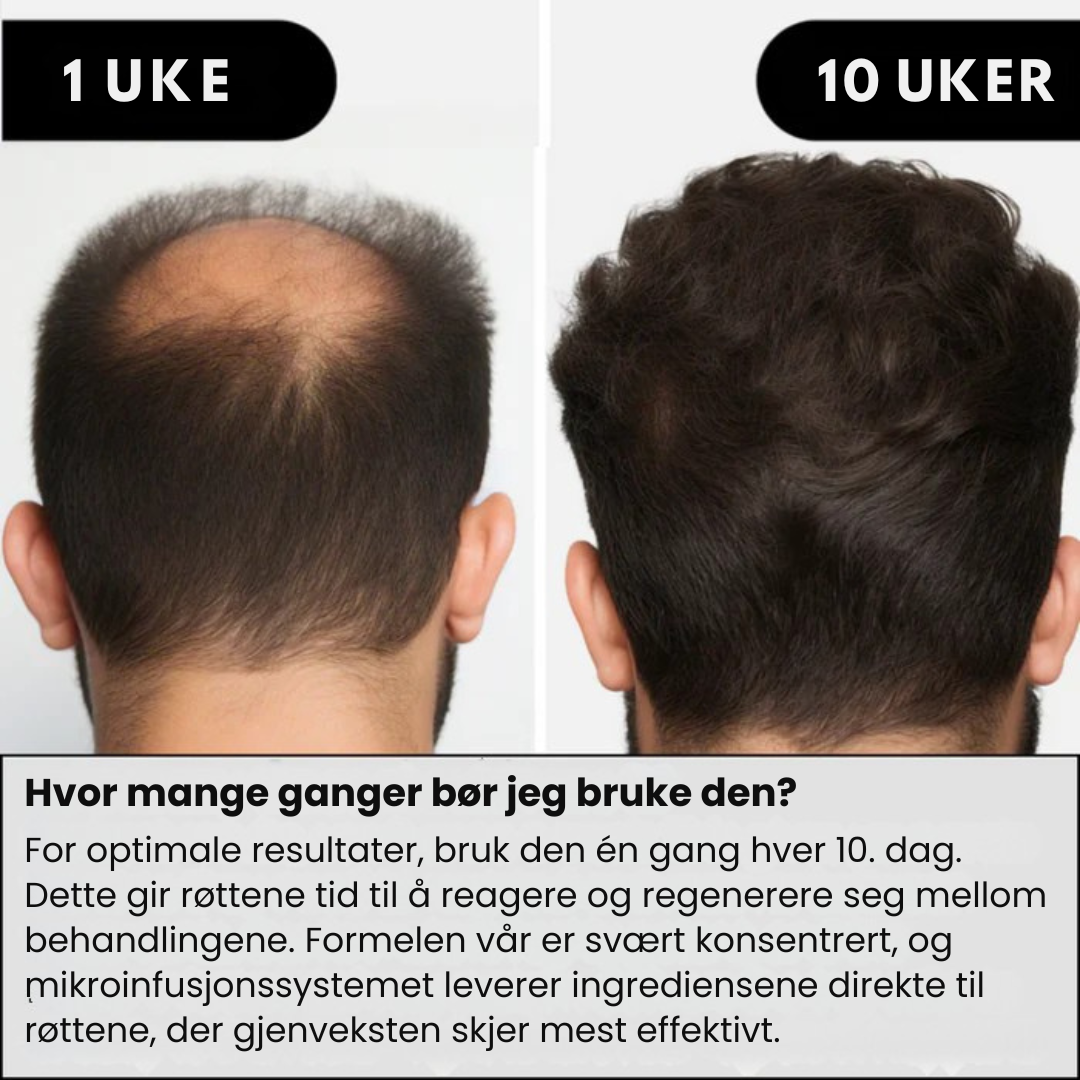Lunaria Mikro-Infusjon Hårvekst