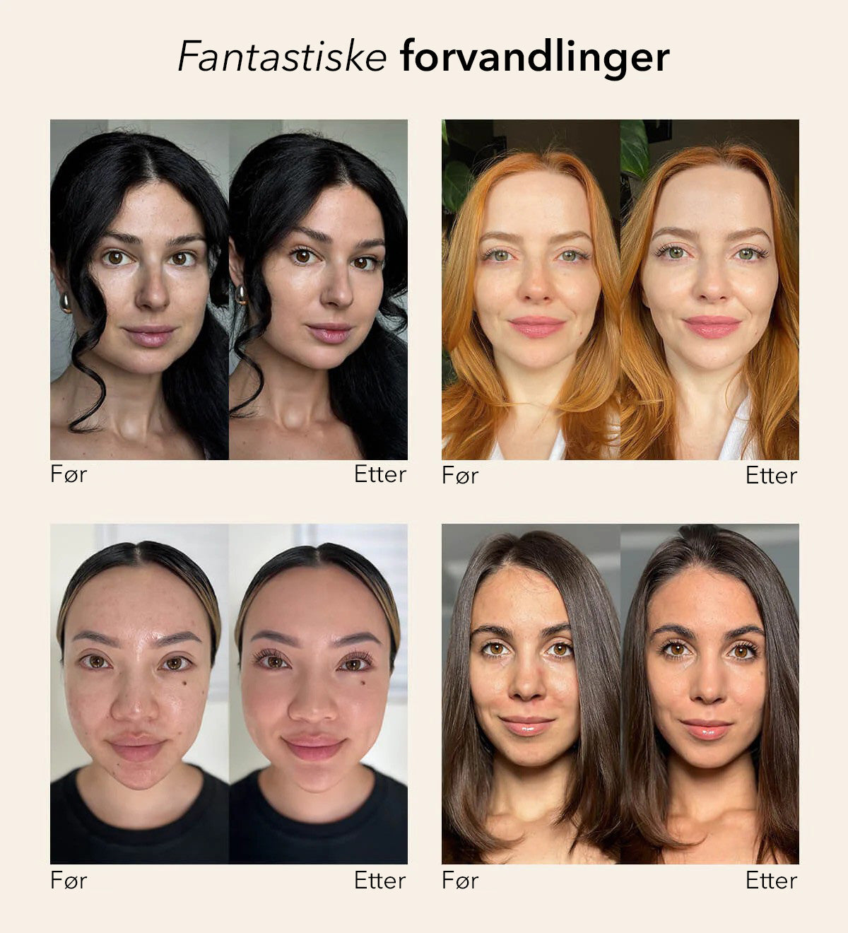 Forandrende Foundation