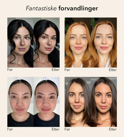 Forandrende Foundation